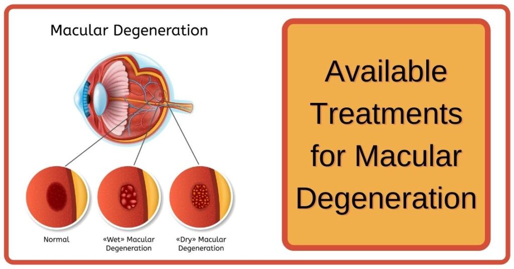 Effective Approaches to age related macular degeneration treatment